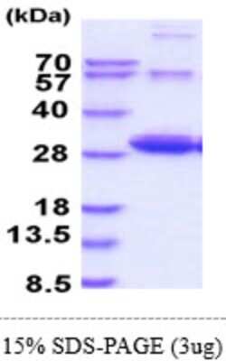 SDS-PAGE: Recombinant Mouse RalA/RalB His Protein [NBP2-61199]