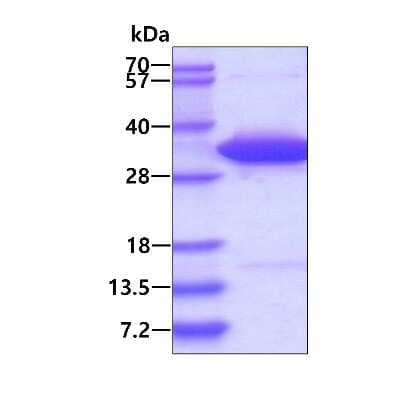 SDS-PAGE: Recombinant Mouse IgG His Protein [NBP1-99014]