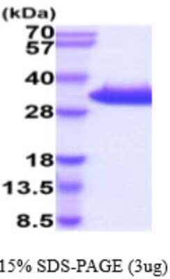 SDS-PAGE: Recombinant Mouse Kallikrein 8/Neuropsin His Protein [NBP2-59574]