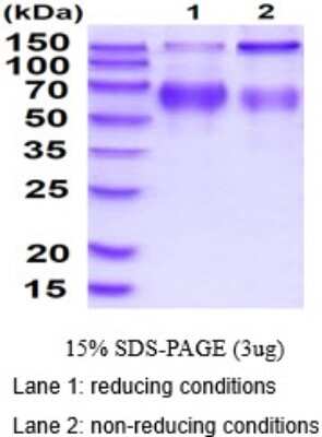 SDS-PAGE: Recombinant Mouse LAMP-2/CD107b His Protein [NBP2-50563]