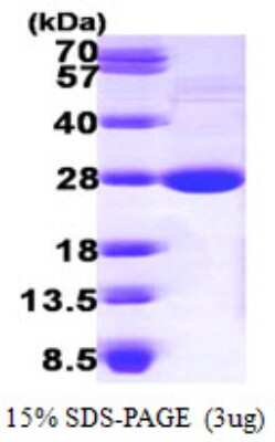 SDS-PAGE: Recombinant Mouse LYPLA1 His Protein [NBP1-48592]