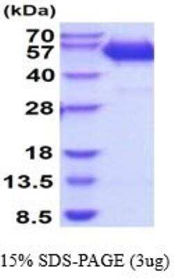 SDS-PAGE: Recombinant Mouse Legumain/Asparaginyl Endopeptidase His Protein [NBP2-52295]