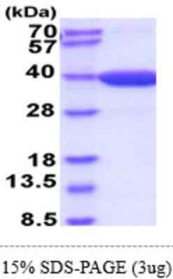 SDS-PAGE: Recombinant Mouse MDH2 His Protein [NBP2-61450]