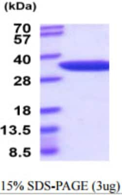 SDS-PAGE: Recombinant Mouse NMNAT-1 His Protein [NBP2-59928]