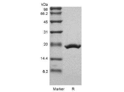 SDS-PAGE: Recombinant Mouse Neuropoietin/NP Protein [NBP2-61439]