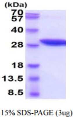 SDS-PAGE: Recombinant Mouse Nicotinamide N-Methyltransferase/NNMT His Protein [NBP2-59656]