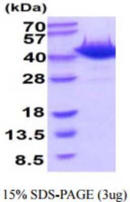 SDS-PAGE: Recombinant Mouse OGG1 His Protein [NBP2-59929]