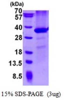 SDS-PAGE: Recombinant Mouse PD-L1 His Protein [NBP1-98887]