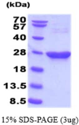 SDS-PAGE: Recombinant Mouse Park7/DJ-1 His Protein [NBP2-59523]