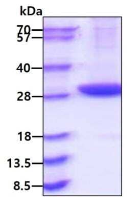 SDS-PAGE: Recombinant Mouse Pentraxin 2/SAP His Protein [NBP2-77502]