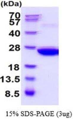 SDS-PAGE: Recombinant Mouse Peroxiredoxin 1 His Protein [NBP2-52340]