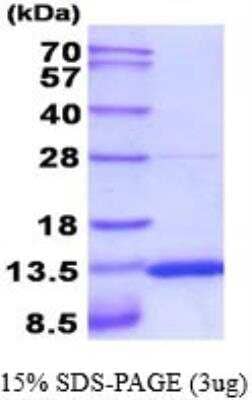 SDS-PAGE: Recombinant Mouse S100A10 His Protein [NBP2-52228]