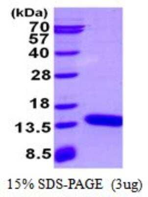 SDS-PAGE: Recombinant Mouse S100A3 His Protein [NBP2-23449]