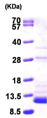 SDS-PAGE: Recombinant Mouse S100B His Protein [NBP1-45273]