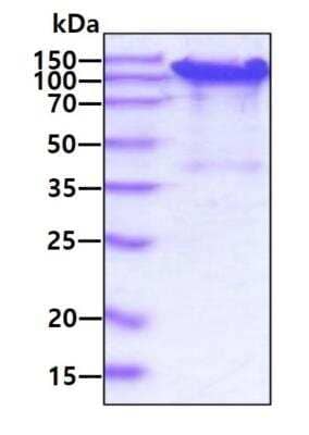 SDS-PAGE: Recombinant Mouse SPARC-like 1/SPARCL1 His Protein [NBP2-77490]