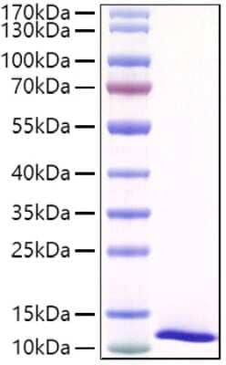 SDS-PAGE: Recombinant Mouse SPINK4 His (C-Term) Protein [NBP3-18208]