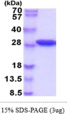 SDS-PAGE: Recombinant Mouse SPR His Protein [NBP2-60206]