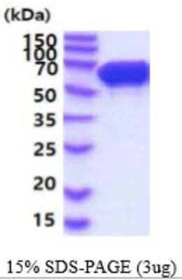 SDS-PAGE: Recombinant Mouse STI1 His Protein [NBP2-59538]