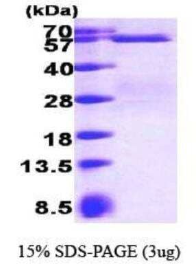 SDS-PAGE: Recombinant Human Smad3 His Protein [NBP1-30284]