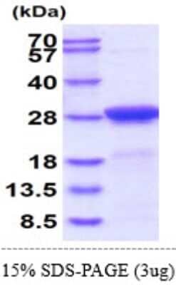 SDS-PAGE: Recombinant Mouse Adenylate Kinase 1 His Protein [NBP2-61200]