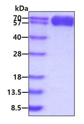 SDS-PAGE: Recombinant Mouse TIM-3 hIgG-His Protein [NBP3-07123]