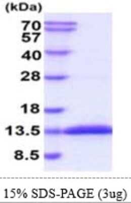 SDS-PAGE: Recombinant Mouse Glutaredoxin 1/GLRX1 His Protein [NBP2-61198]