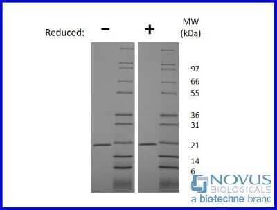 SDS-PAGE: Recombinant Mouse TRANCE/TNFSF11/RANK L Animal-Free Protein [NBP2-76186]