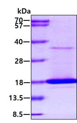 SDS-PAGE: Recombinant Mouse TRANCE/TNFSF11/RANK L Protein [NBP2-77509]