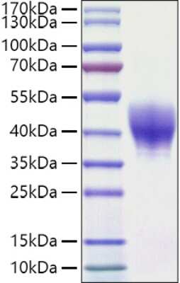 SDS-PAGE: Recombinant Mouse TROP-2 His (C-Term) Protein [NBP3-18209]