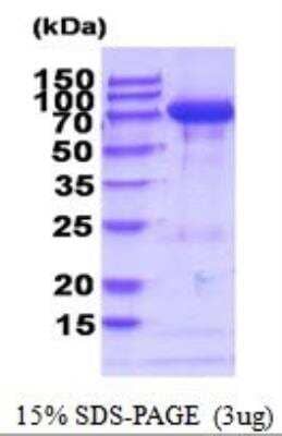 SDS-PAGE: Recombinant Mouse Transglutaminase 2/TGM2 His Protein [NBP2-52044]