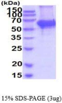 SDS-PAGE: Recombinant Mouse Tyrosine Hydroxylase His Protein [NBP2-52633]