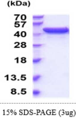 SDS-PAGE: Recombinant Mouse UDP glucose dehydrogenase His Protein [NBP2-61452]