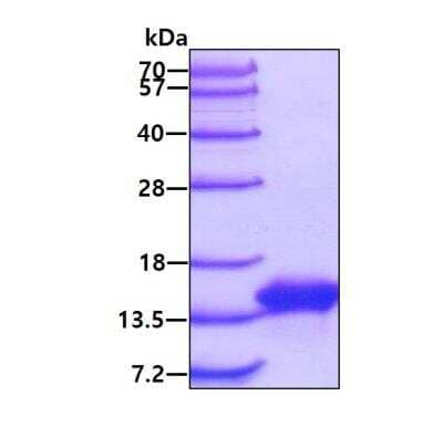 SDS-PAGE: Recombinant Mouse VAMP-7 His Protein [NBP2-59576]