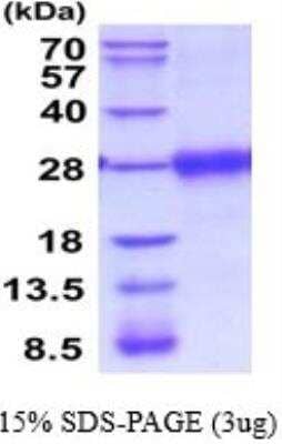 SDS-PAGE: Recombinant Mouse VISTA/B7-H5/PD-1H His Protein [NBP2-52229]