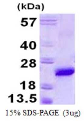 SDS-PAGE: Recombinant Mouse VPS29 His Protein [NBP1-99056]