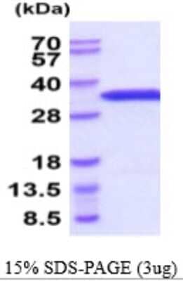 SDS-PAGE: Recombinant Mouse eIF4E His Protein [NBP2-59571]