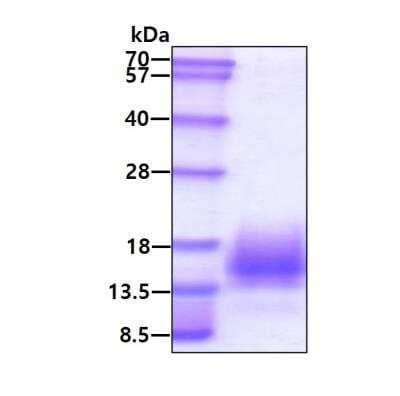 SDS-PAGE: Recombinant Mycobacterium Tuberculosis ESAT6 His Protein [NBP1-99045]