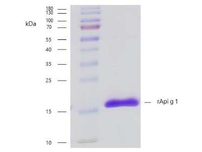 SDS-PAGE: Recombinant Plant Apium graveolens 1.0101 His (C-Term) Protein [NBP3-06711]