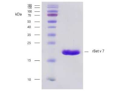 SDS-PAGE: Recombinant Plant Betula verrucosa 7.0101 Strep (N-Term) Protein [NBP3-06725]