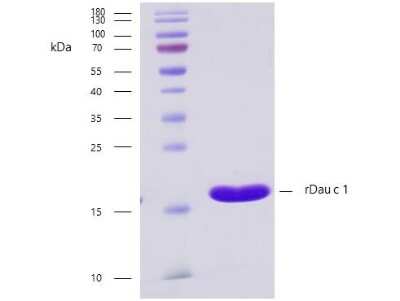 SDS-PAGE: Recombinant Plant Daucus carota 1.0101 Strep (N-Term) Protein [NBP3-06720]