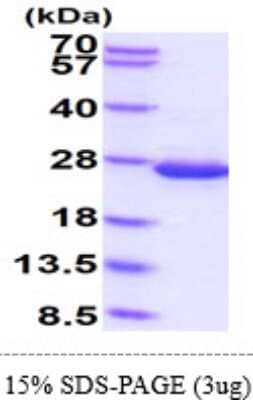 SDS-PAGE: Recombinant E. coli Disulfide isomerase II Protein [NBP2-61460]