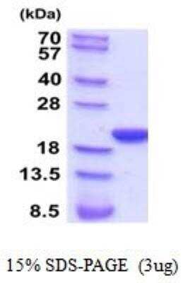 SDS-PAGE: Recombinant Rat Cyclophilin-F His Protein [NBP2-52132]