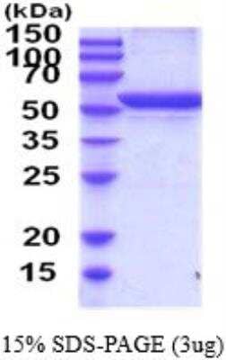 SDS-PAGE: Recombinant Rat GPT His Protein [NBP2-52163]