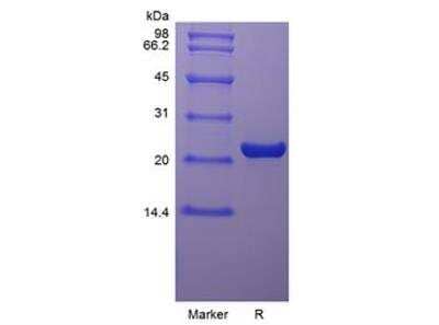 SDS-PAGE: Recombinant Rat Oncostatin M/OSM Protein [NBP2-35280]