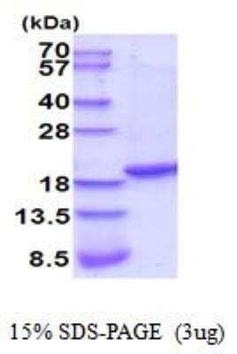 SDS-PAGE: Recombinant Rat TNF-alpha His Protein [NBP2-52131]