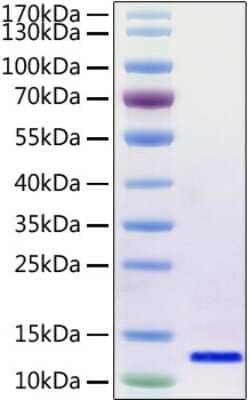 SDS-PAGE: Recombinant SARS-CoV-2 Envelope (Avi Epitope Tag) His (N-Term) Avi-tag Protein [NBP2-90986]