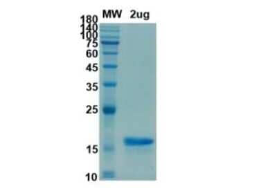 SDS-PAGE: Recombinant SARS-CoV-2 Membrane Protein His (N-Term) Protein [NBP3-07080]