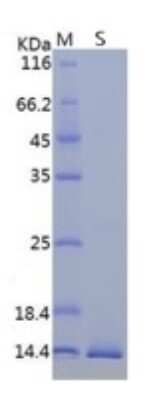 SDS-PAGE: Recombinant SARS-CoV-2 ORF8 His Protein [NBP3-07089]