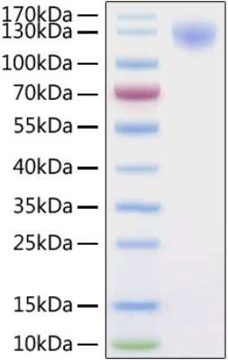 SDS-PAGE: Recombinant SARS-CoV-2 Spike S1 His (C-Term) Protein [NBP2-90985]