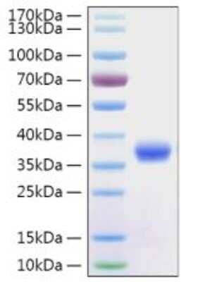 SDS-PAGE: Recombinant SARS-CoV-2 Spike S1 (RBD) His (C-Term) Protein [NBP2-90982]